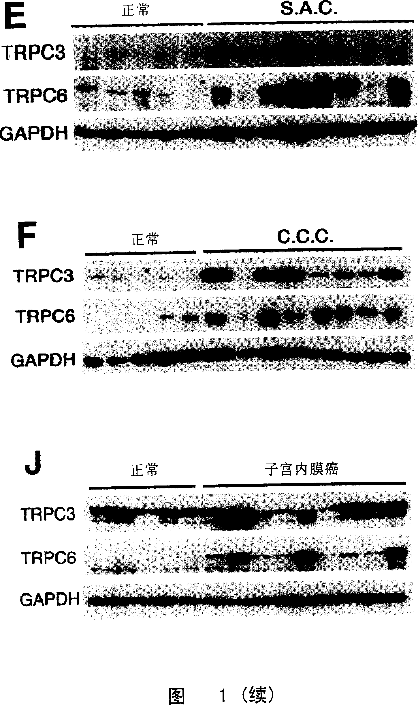 Application of TRPC in screening antitumour medicine and medical use of its inhibitor