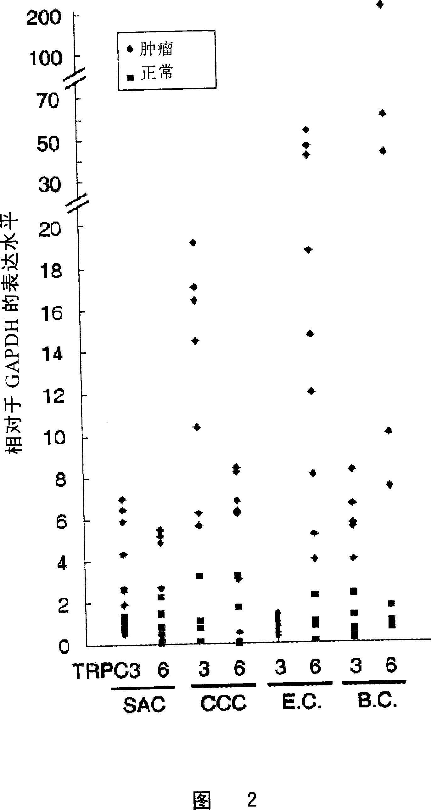 Application of TRPC in screening antitumour medicine and medical use of its inhibitor