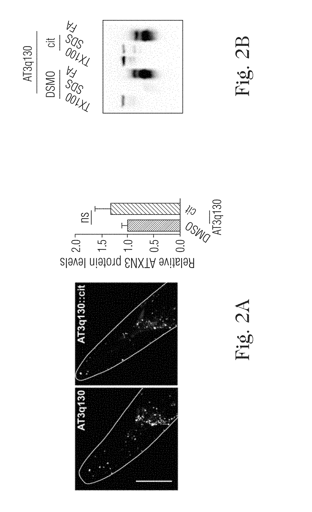 Citalopram or escitalopram for use in the treatment of neurodegenerative diseases