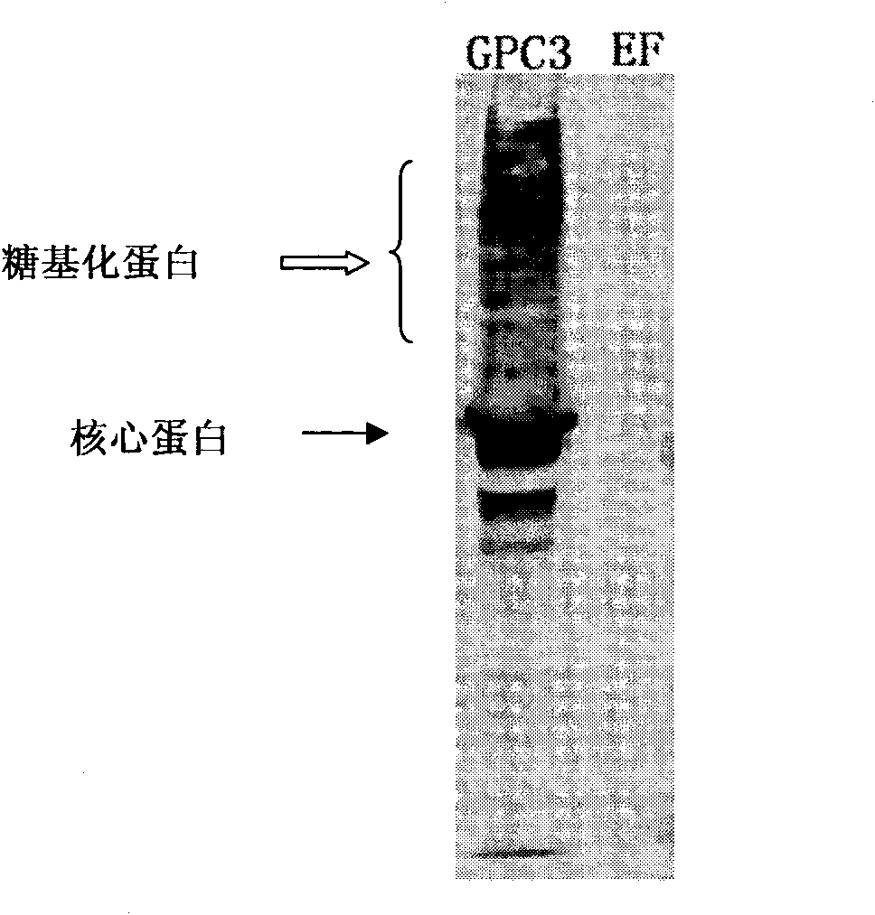 Monoclonal antibody for resisting GPC3