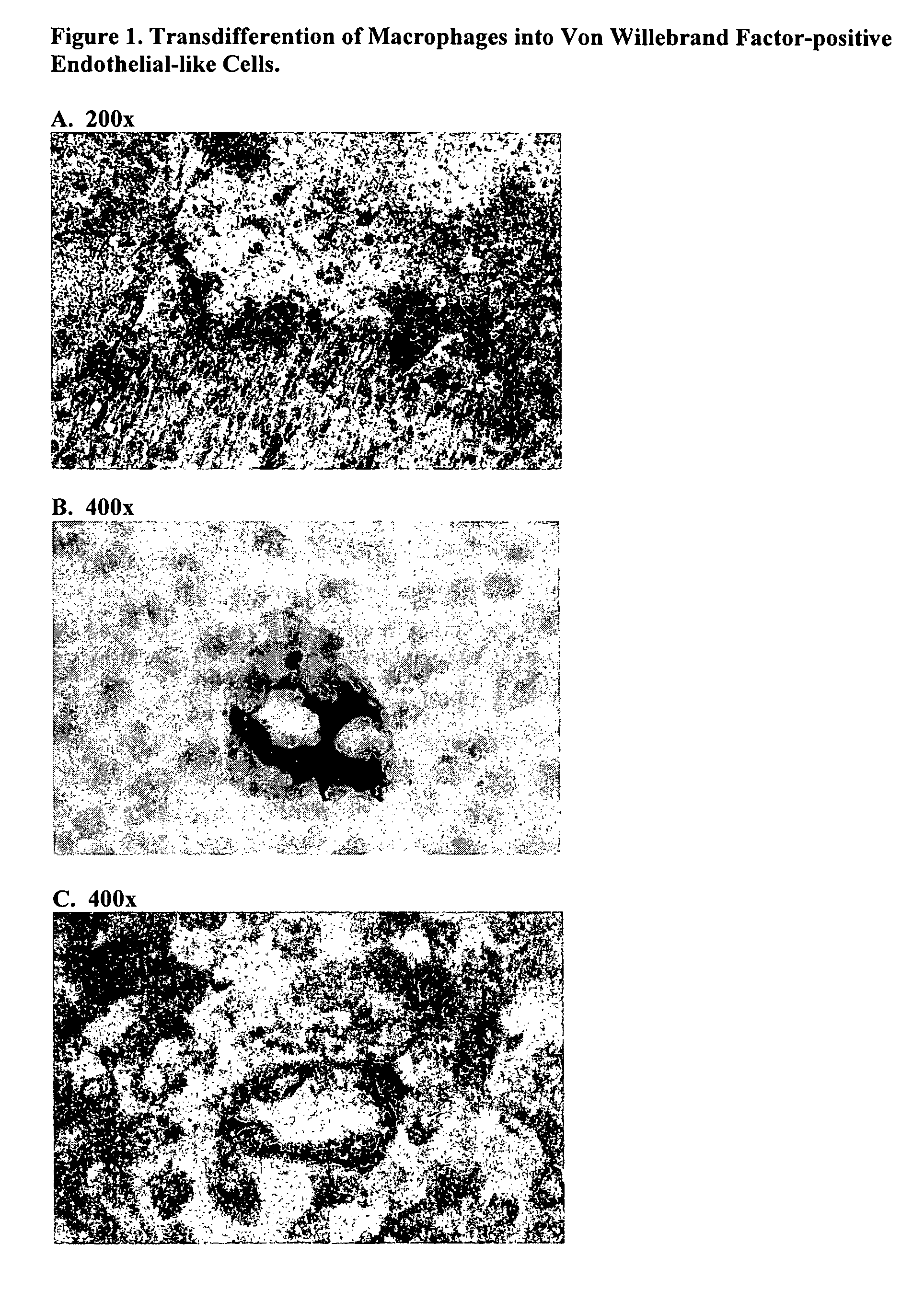 Acellular bioabsorbable tissue regeneration matrices