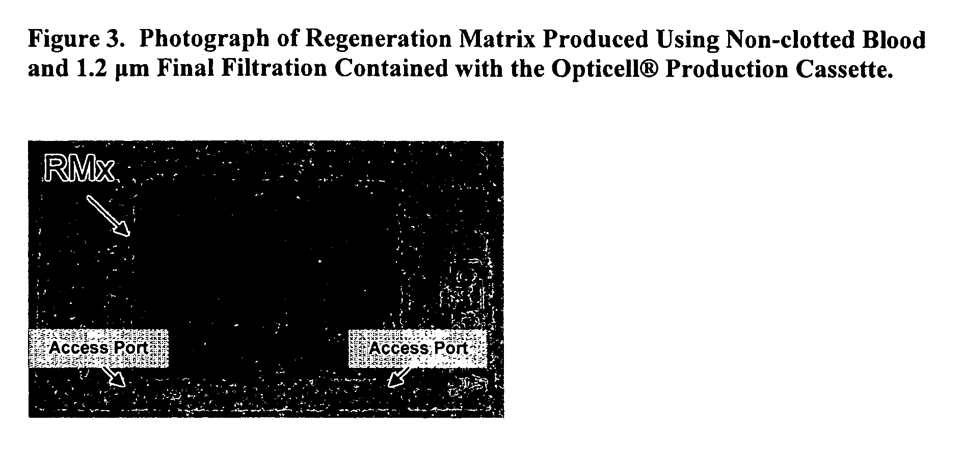 Acellular bioabsorbable tissue regeneration matrices