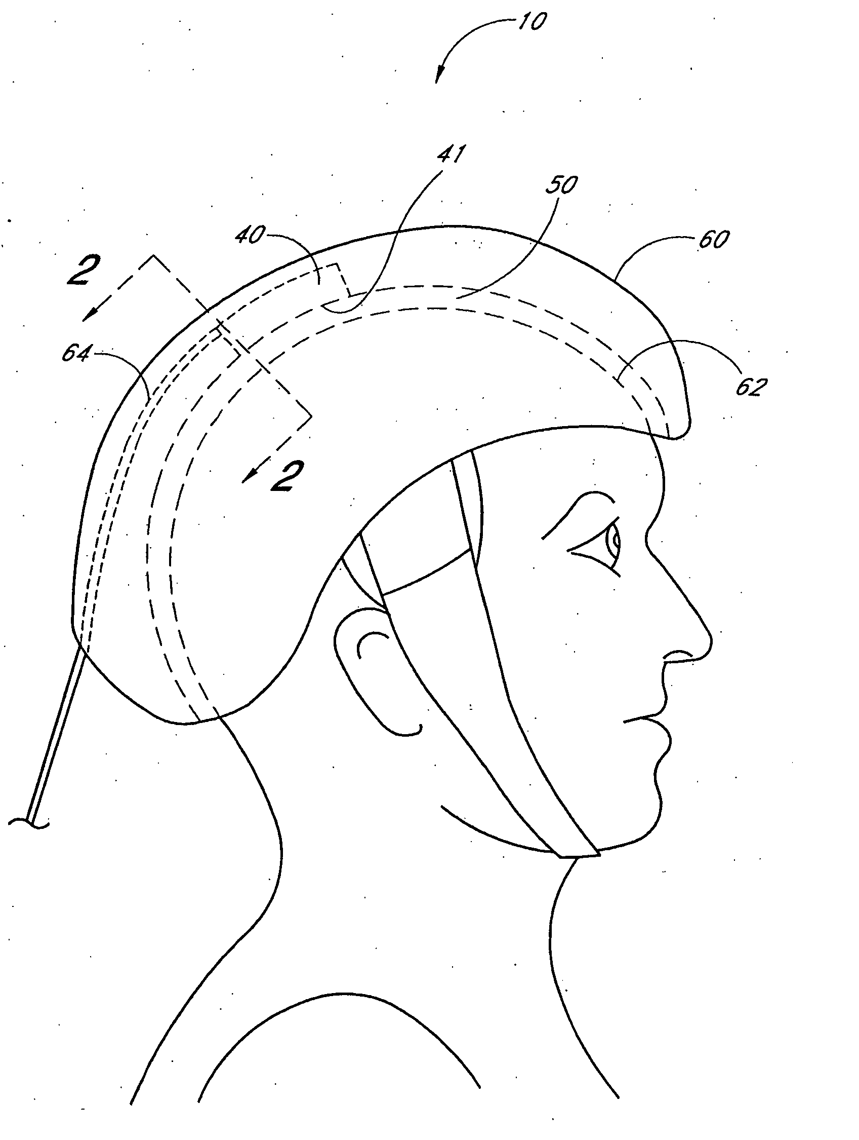 Device and method for providing phototherapy to the brain