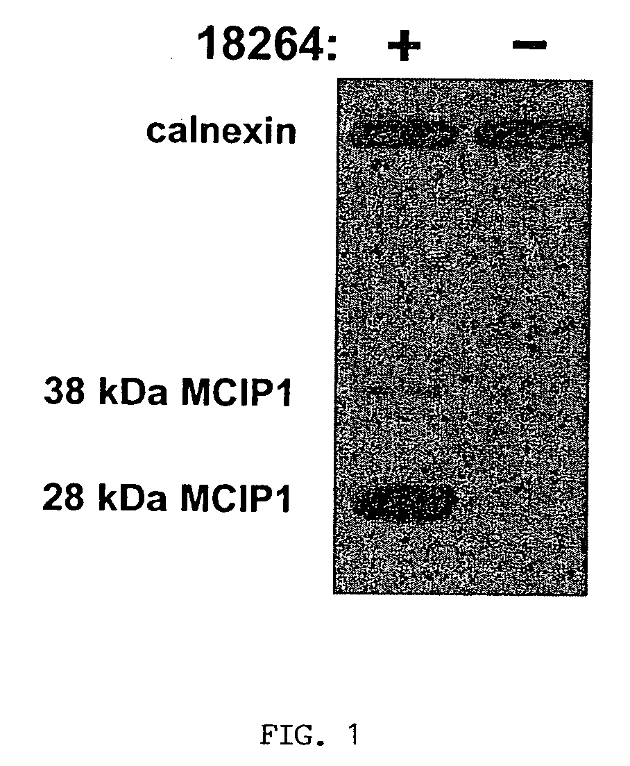 Modulation of 5-HT2 receptors as a treatment for cardiovascular diseases