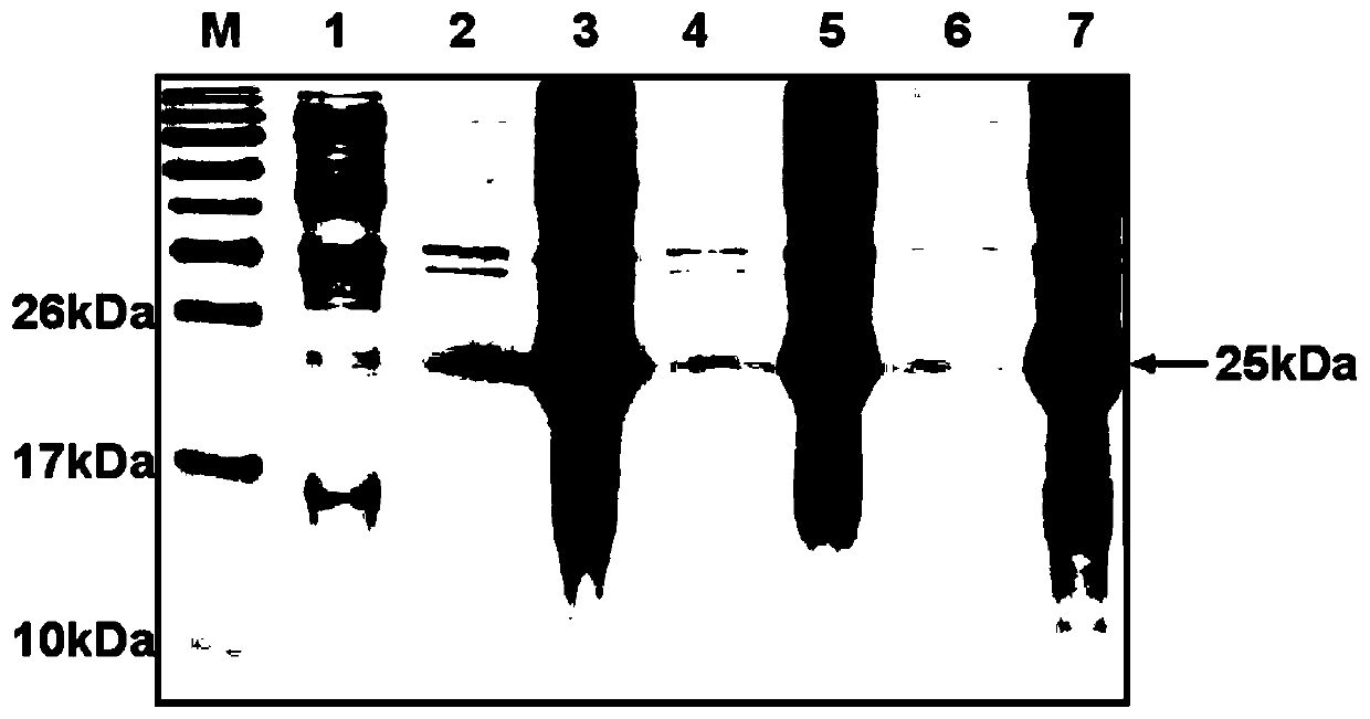 Preparation method of recombinant human insulin