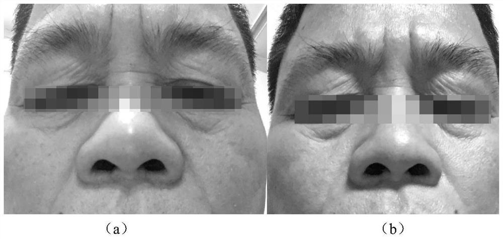 Pharmaceutical composition for facial mask, preparation method of pharmaceutical composition and facial mask containing pharmaceutical composition