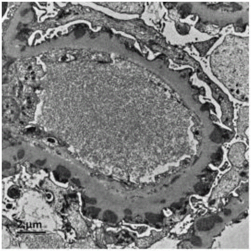 Vacuum dyeing method for ultrathin sections of electron microscope