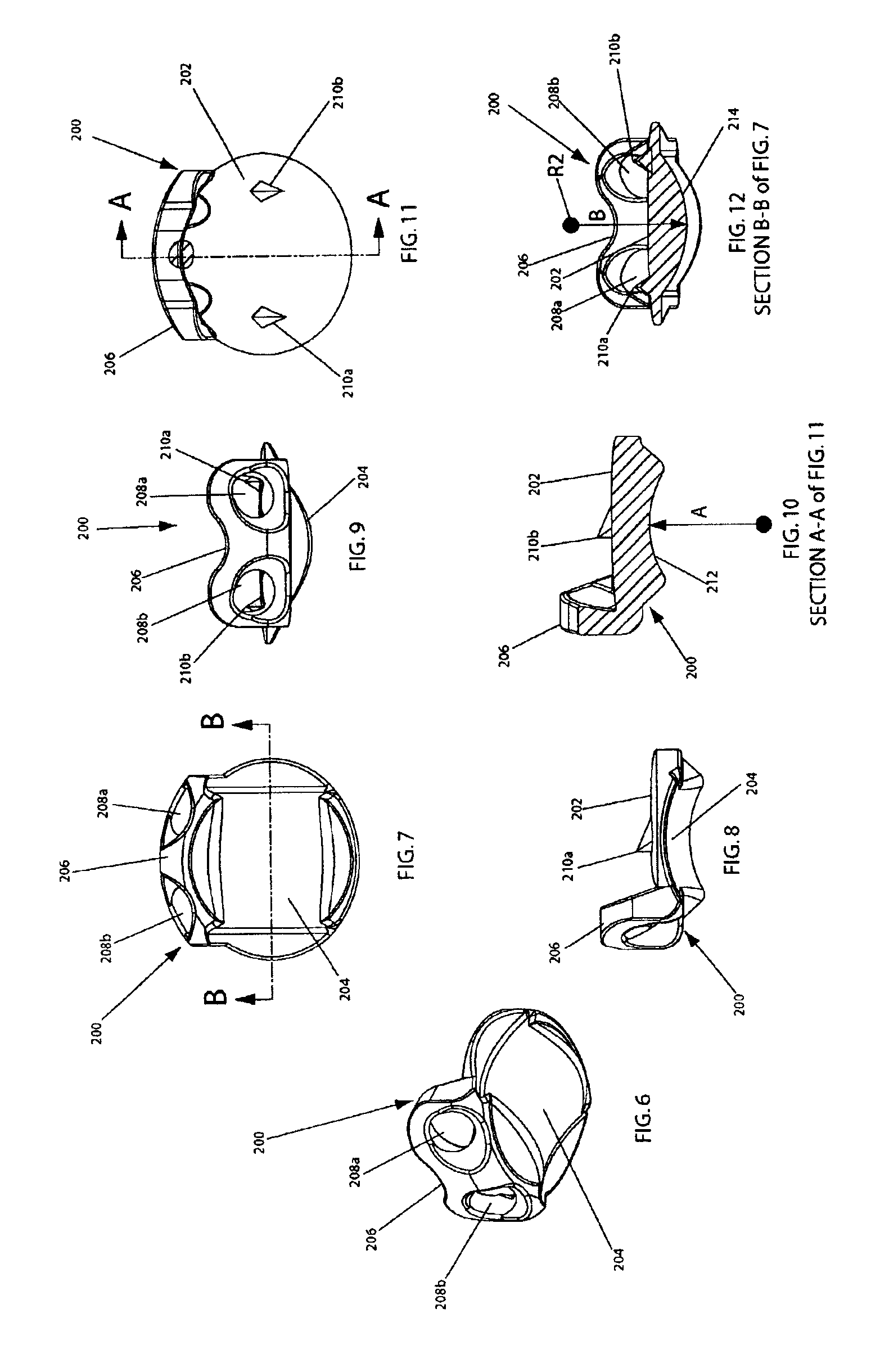 Cervical disc replacement