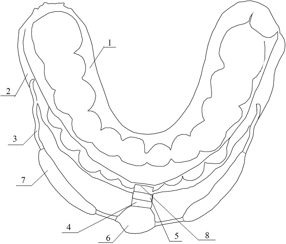 Magnetism guide functional oral appliance