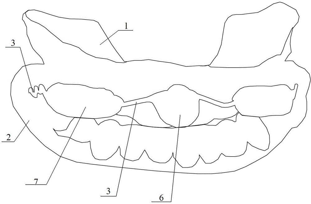 Magnetism guide functional oral appliance