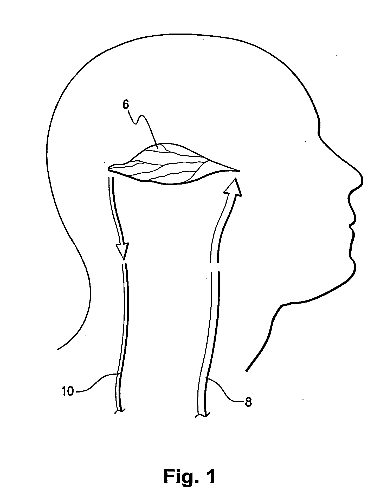 Method and system of obtaining improved data in perfusion measurements