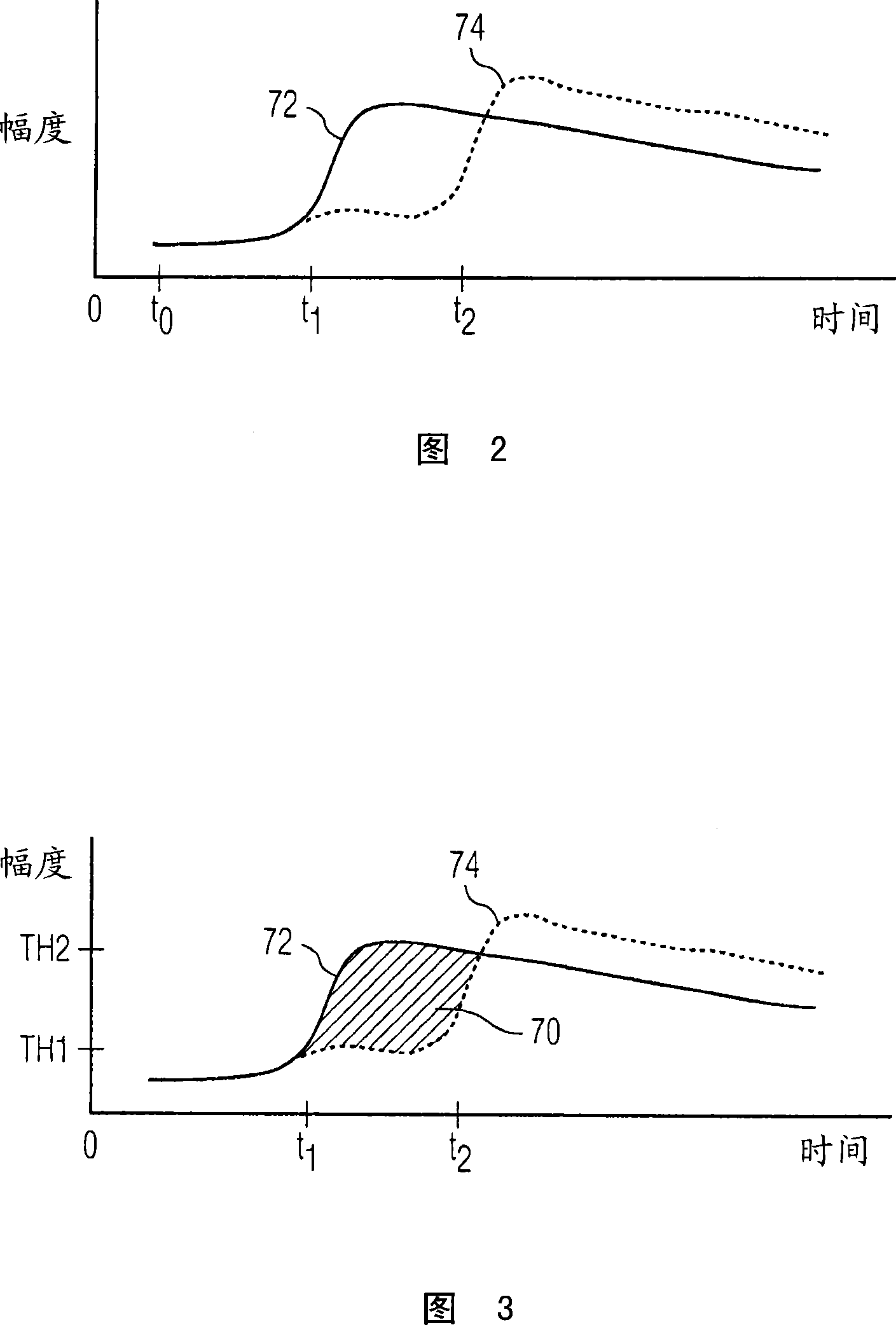 Ultrasonic diagnostic imaging system and method for detecting lesions of the liver