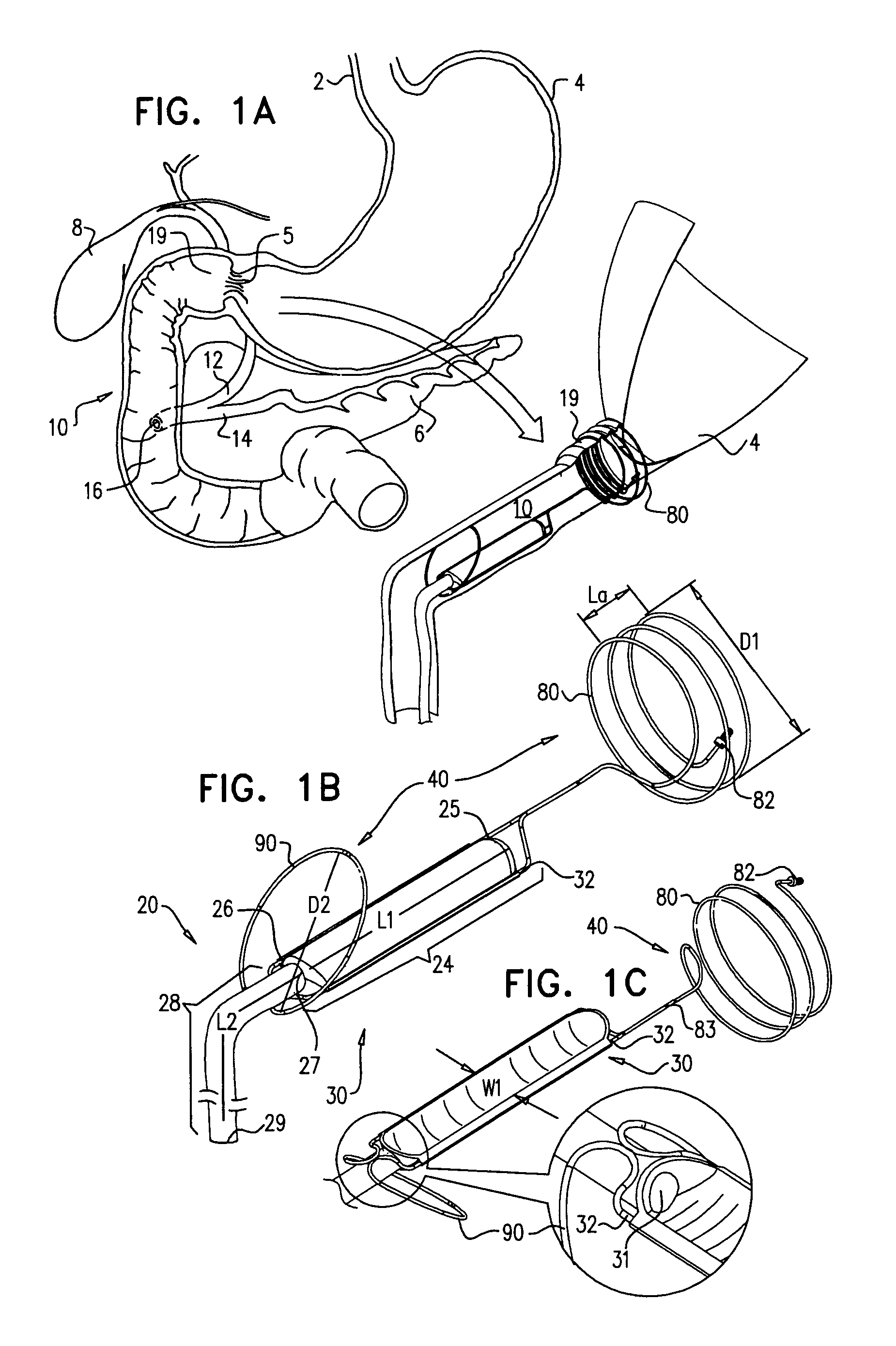 Pancreaticobiliary diversion device