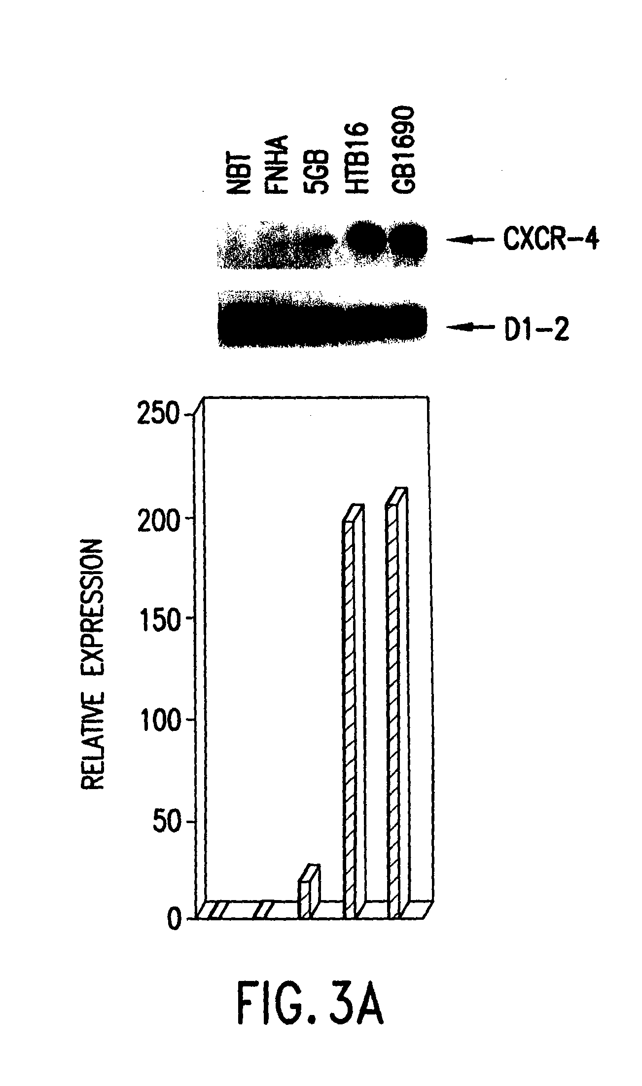 Therapeutic and diagnostic applications based on the role of the cxcr-4 gene in tumorigenesis