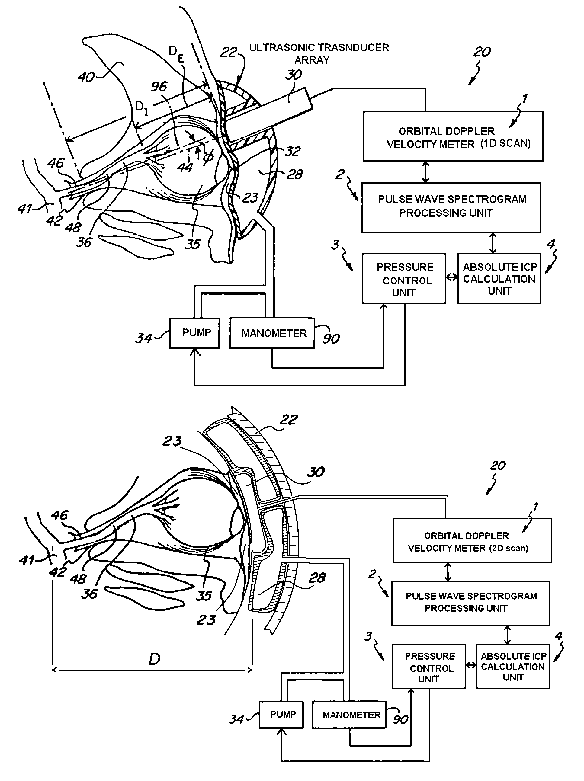 Method and apparatus for determining the absolute value of intracranial pressure