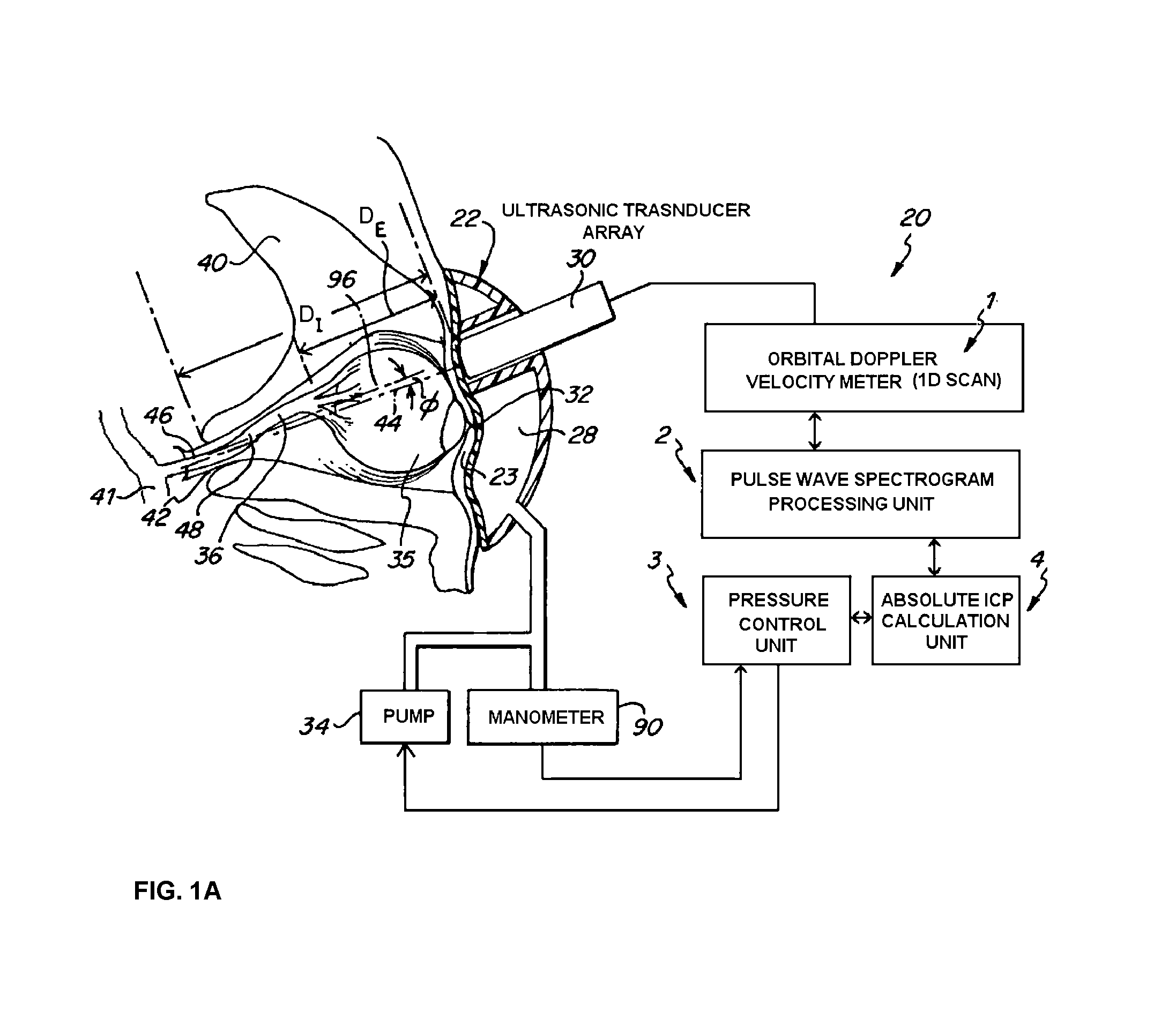 Method and apparatus for determining the absolute value of intracranial pressure