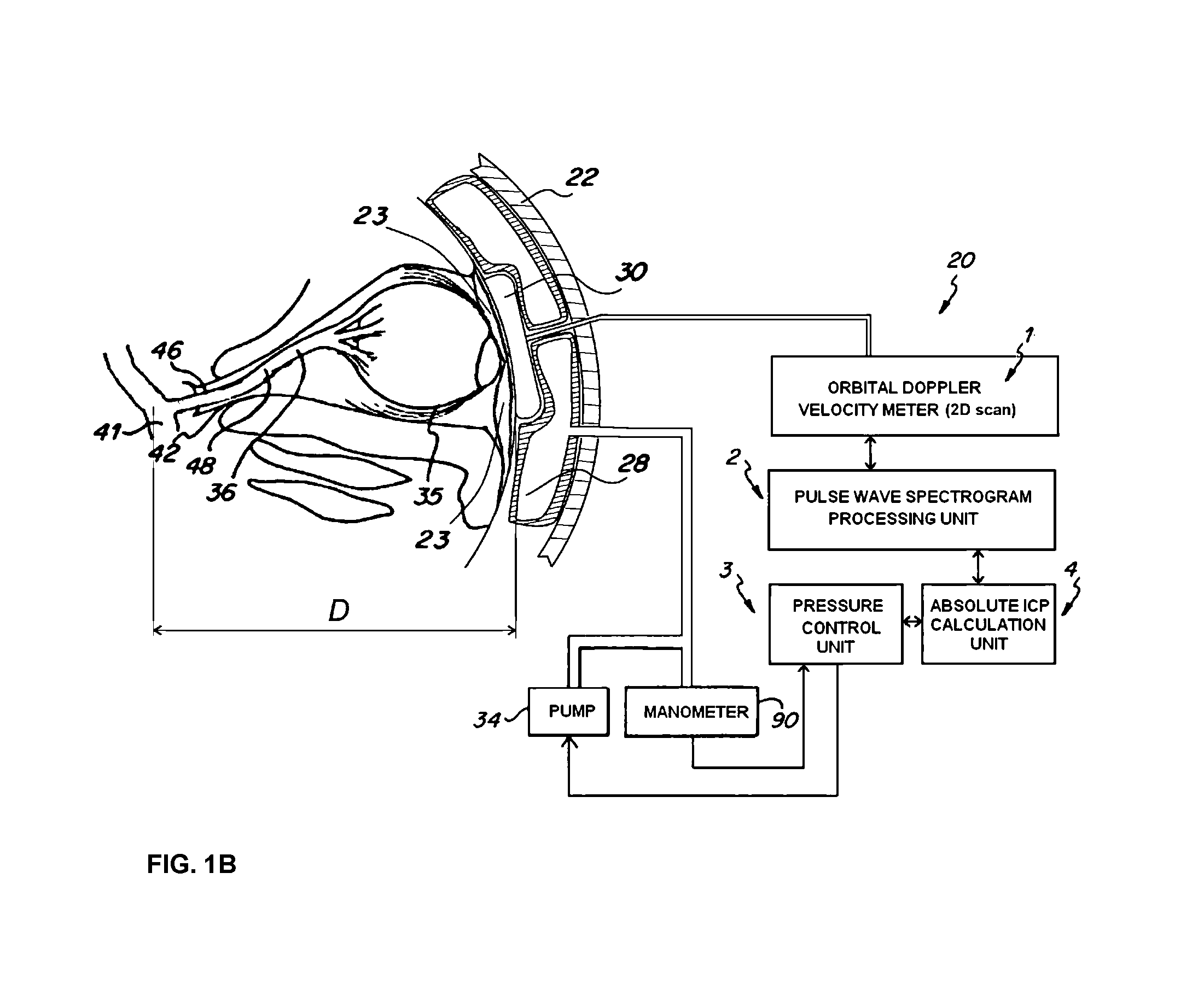 Method and apparatus for determining the absolute value of intracranial pressure