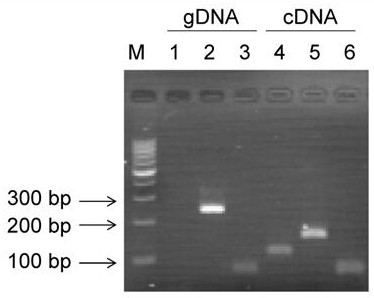 A kind of circular RNAcircbcbm1 and its non-diagnostic fluorescence quantitative detection method