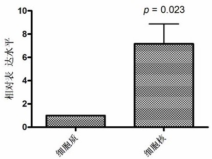 A kind of circular RNAcircbcbm1 and its non-diagnostic fluorescence quantitative detection method