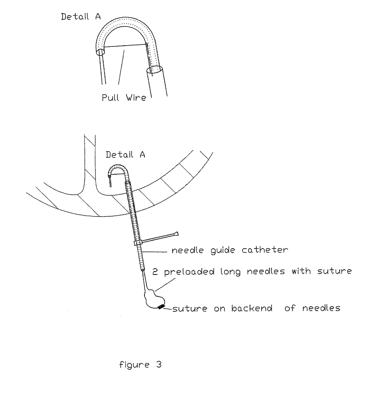 Cardiovascular procedures