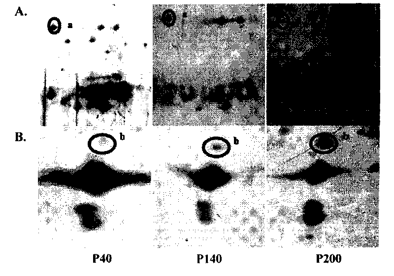 Cathepsin D antigen polypeptide and application thereof as well as detecting kit containing polypeptide