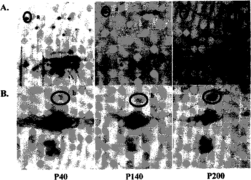 Cathepsin D antigen polypeptide and application thereof as well as detecting kit containing polypeptide