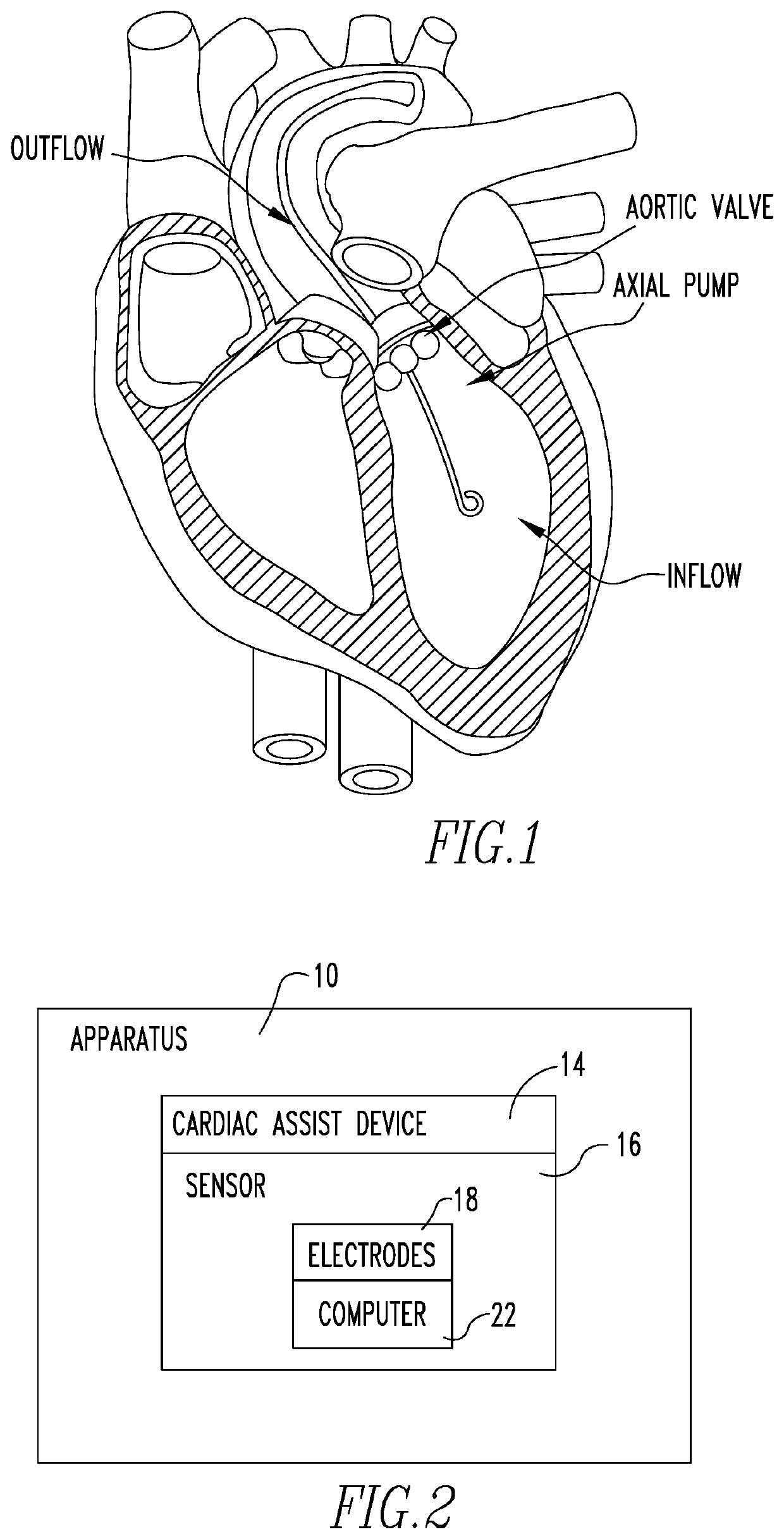 Method and Apparatus for Assisting a Heart