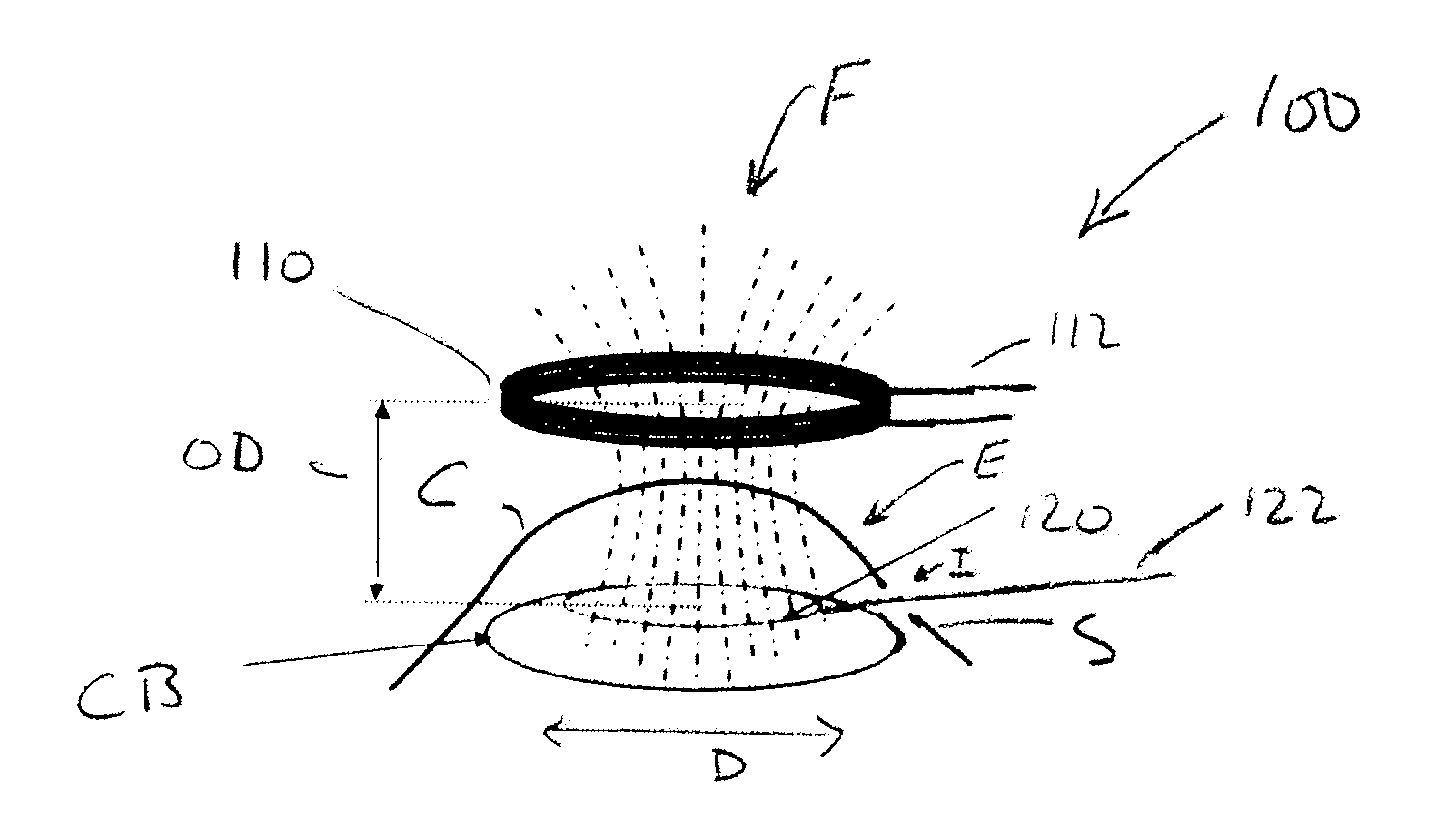 Capsulotomy device and method using electromagnetic induction heating