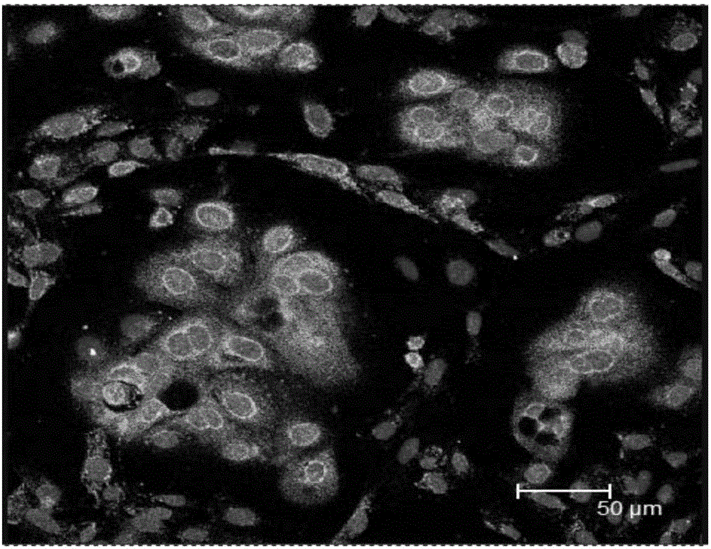 Application of vaccaria segetalis seed extract in promotion of cow lactation