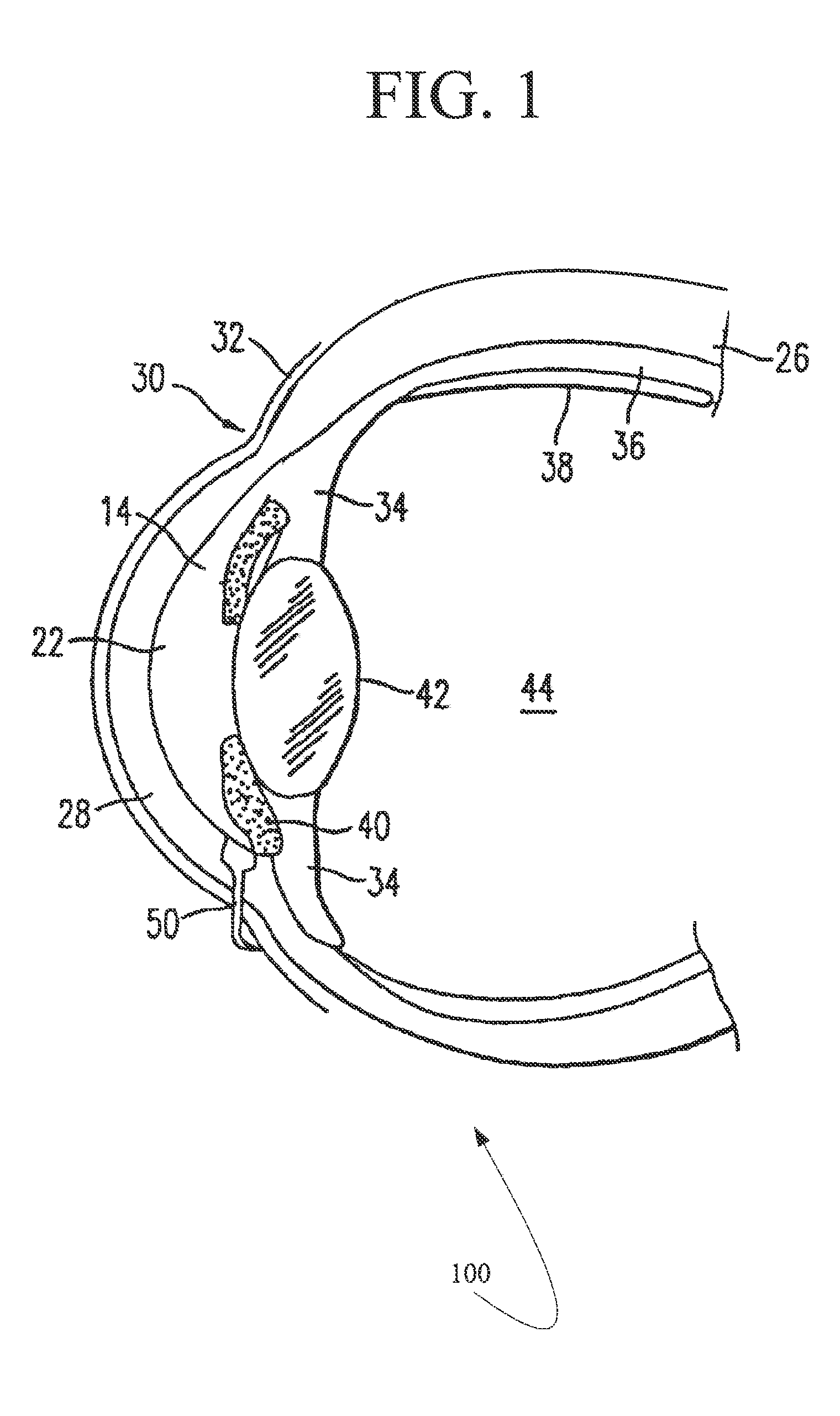 Biocompatible glaucoma drainage device