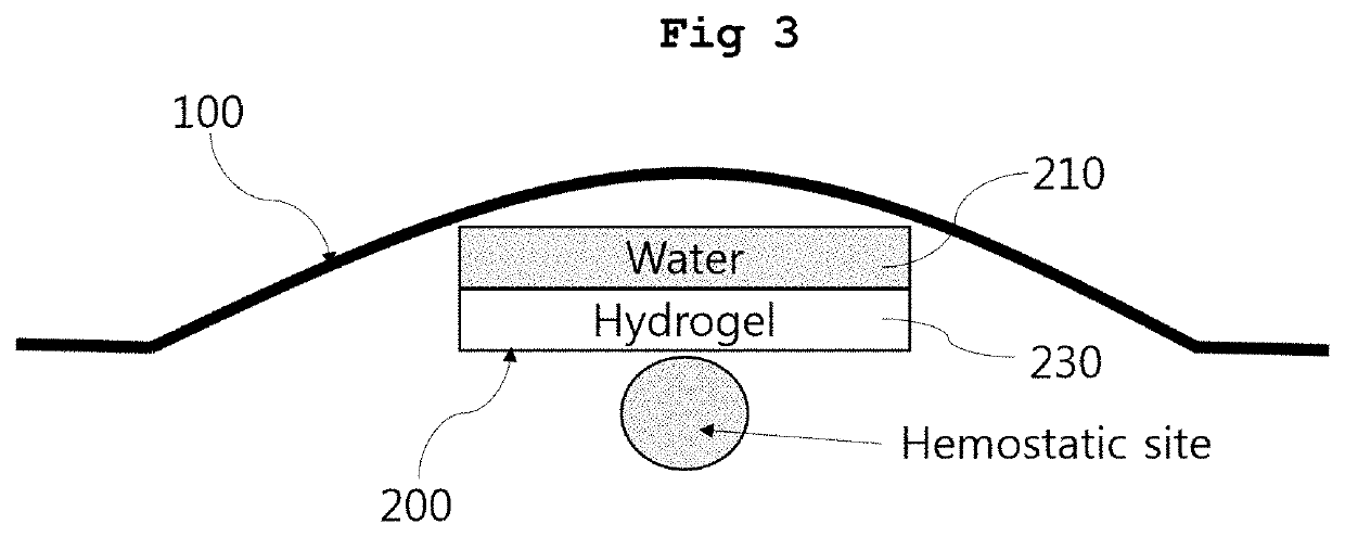 Expandable compression bandage for hemostasis