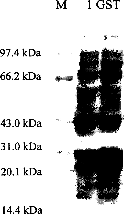 Nucleus factor-kB p50 subunit combination peptide, preparation and application thereof