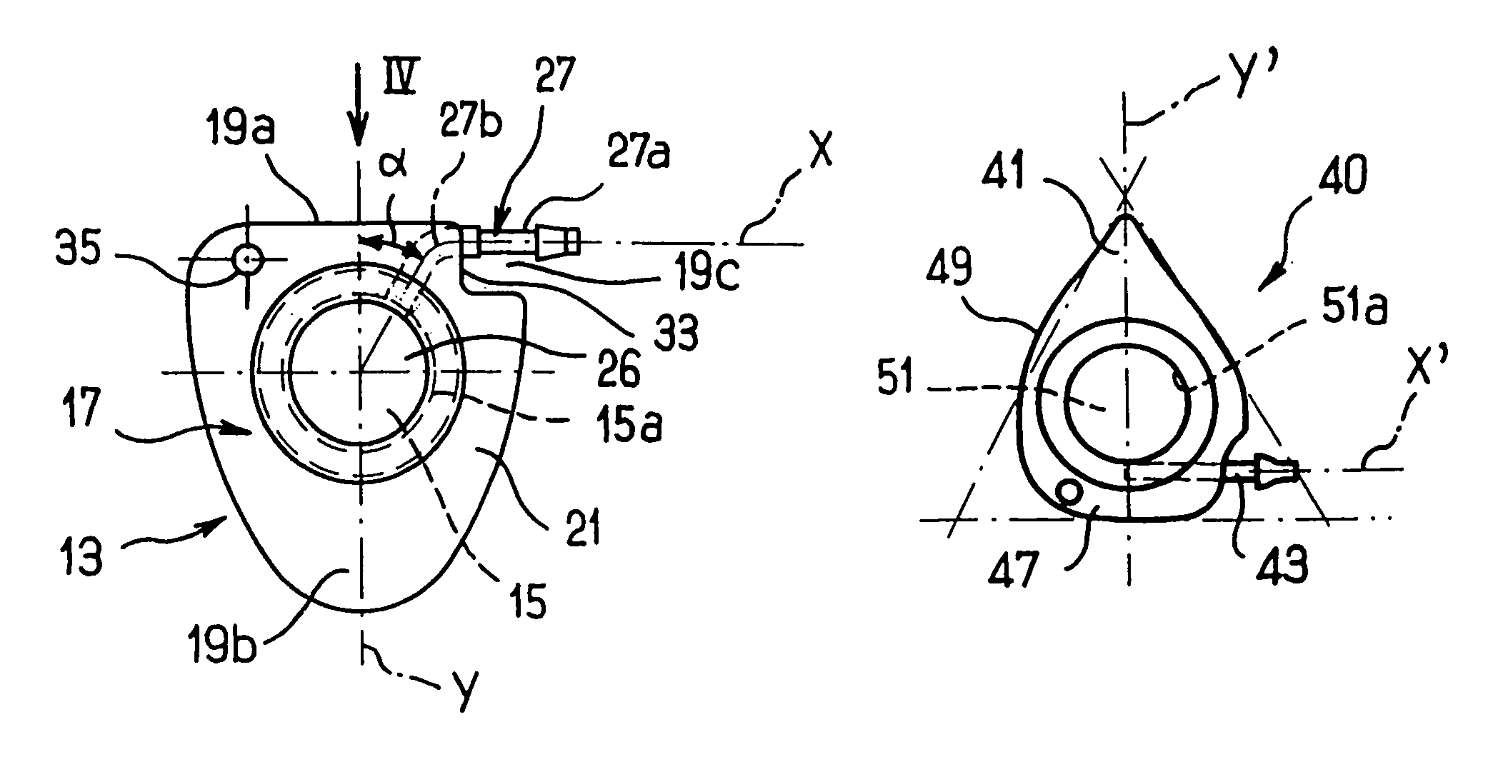 Subcutaneously implantable access port