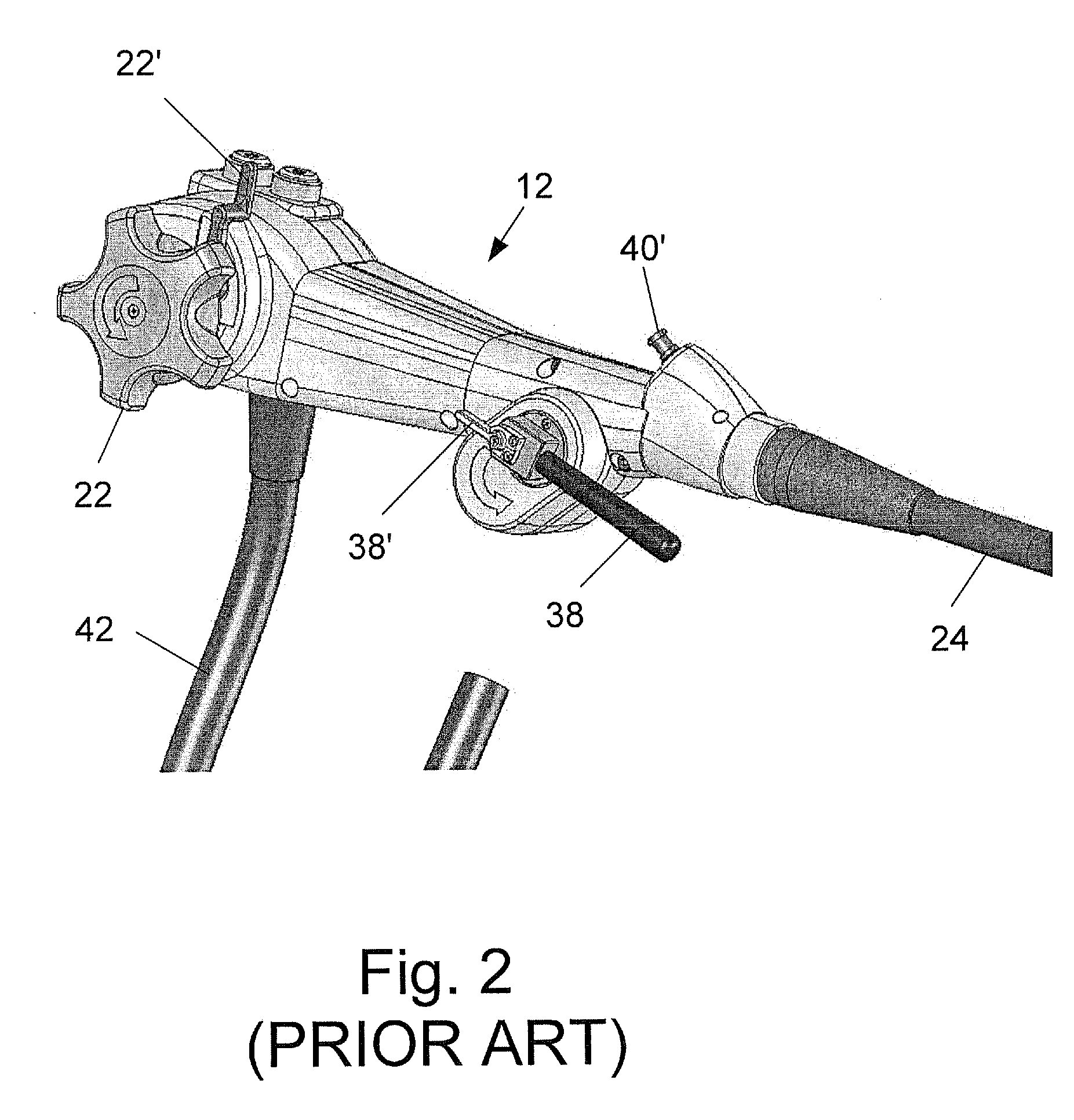 Devices and Methods for Treating Morbid Obesity