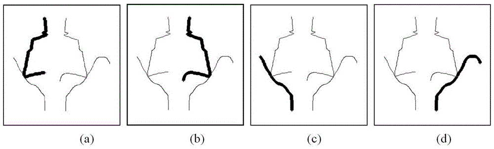 Image symmetry axis detection method based on edge line matching