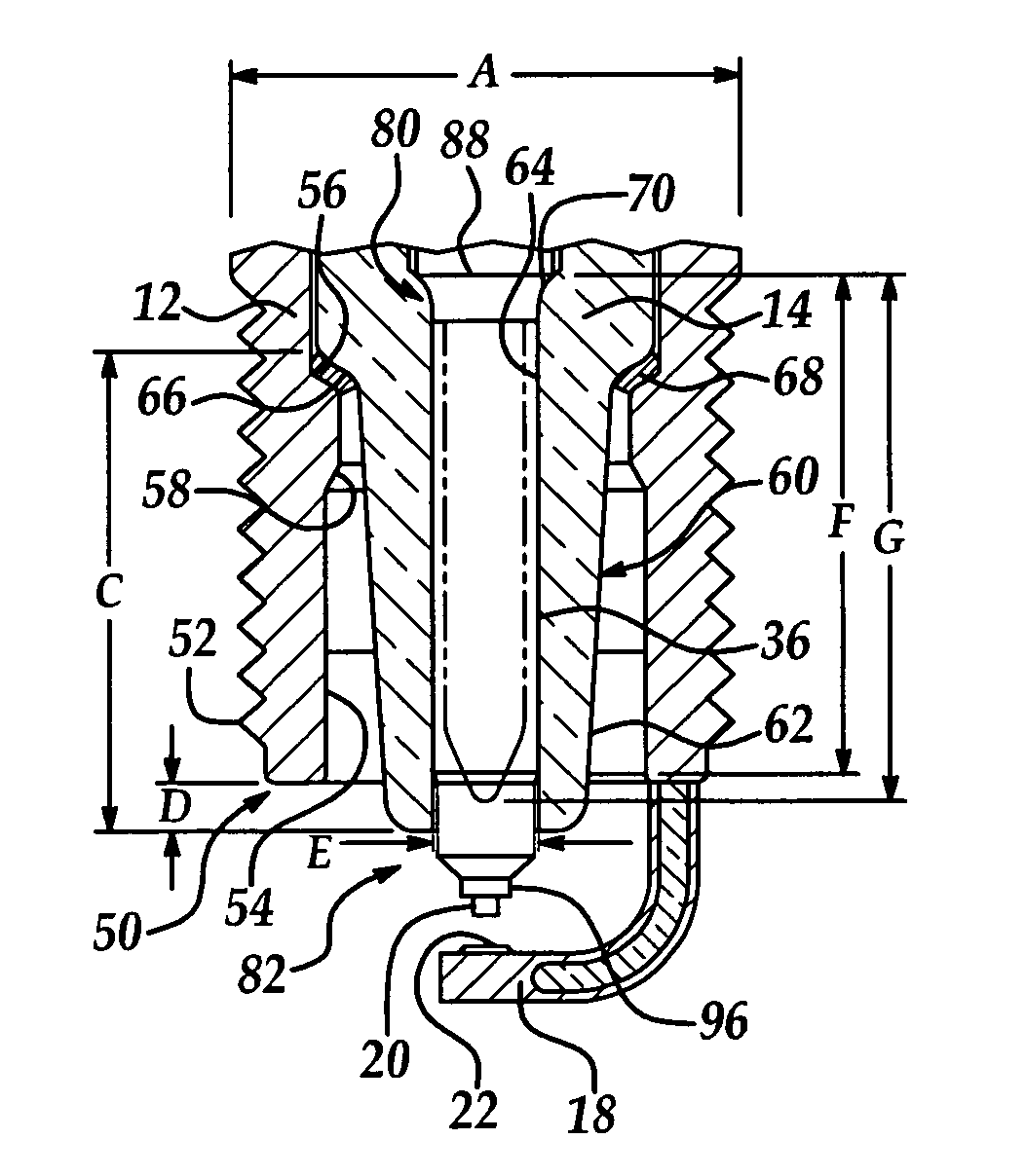 Spark plug configuration having a metal noble tip