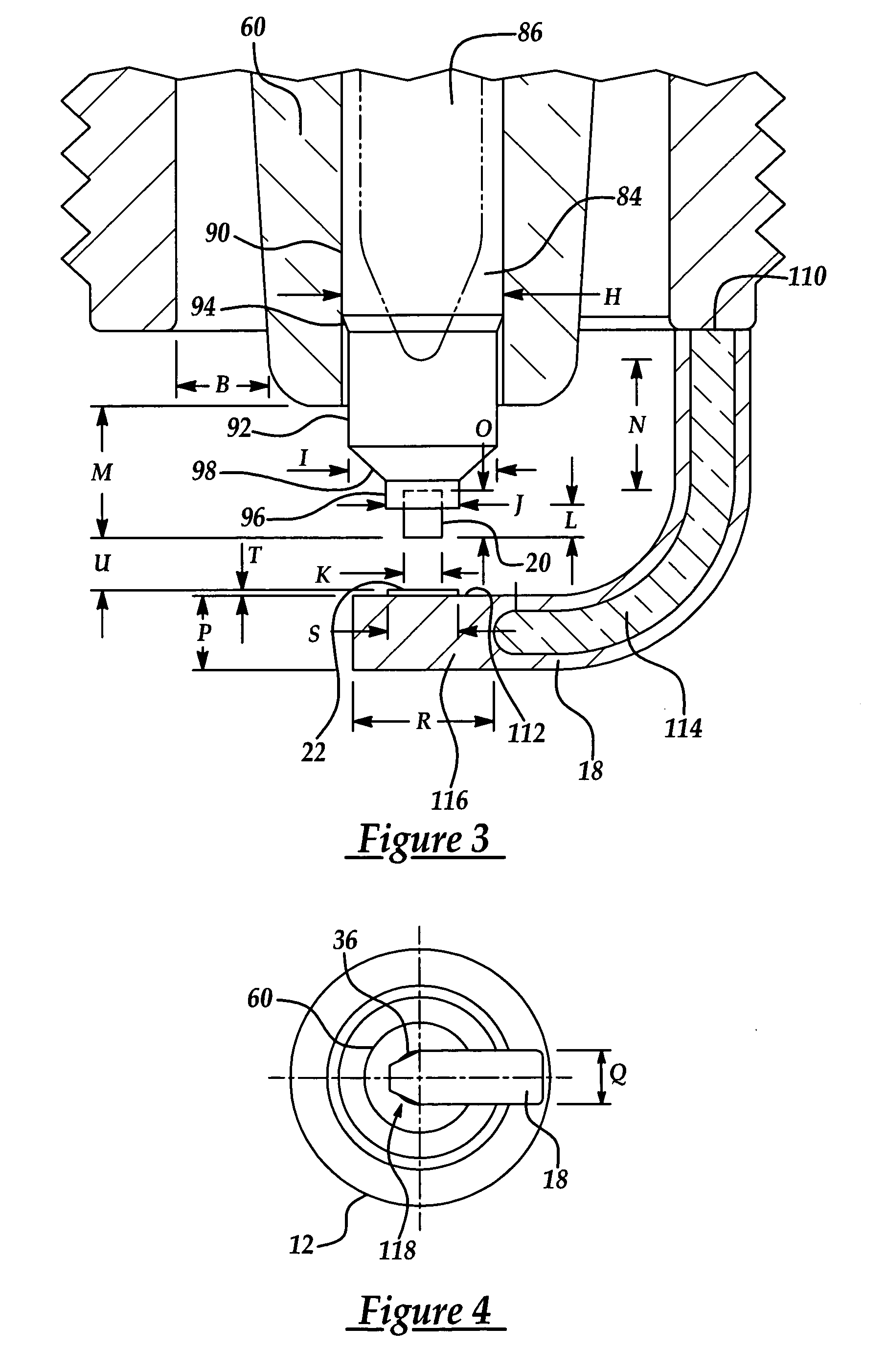 Spark plug configuration having a metal noble tip