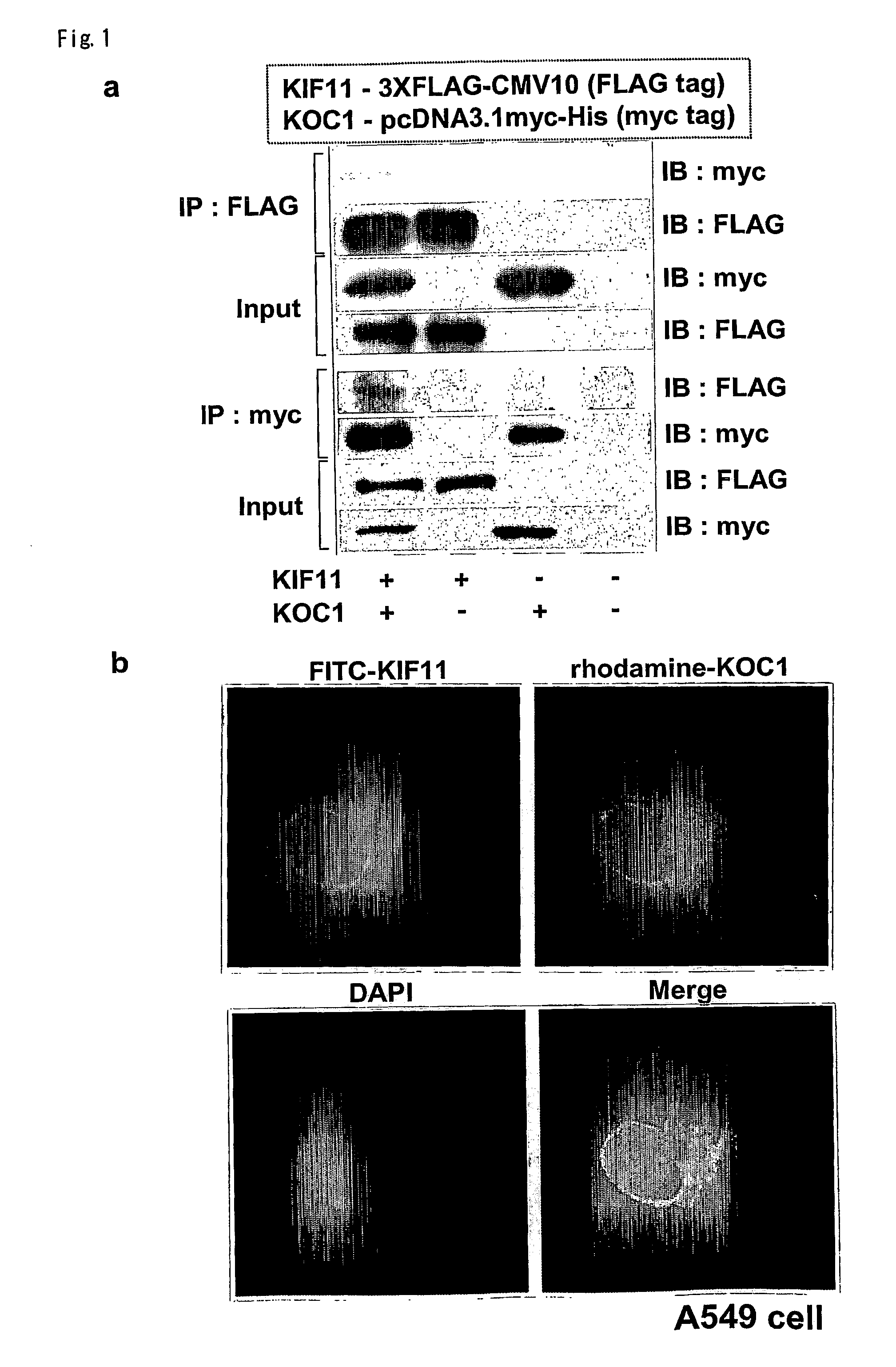 Method for Diagnosing Non-Small Cell Lung Cancer