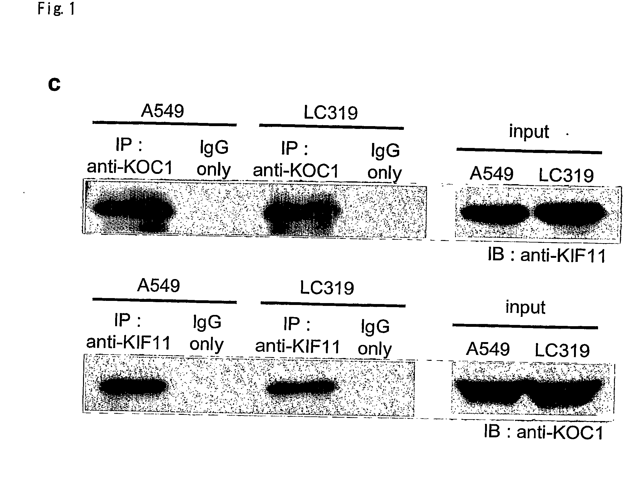 Method for Diagnosing Non-Small Cell Lung Cancer