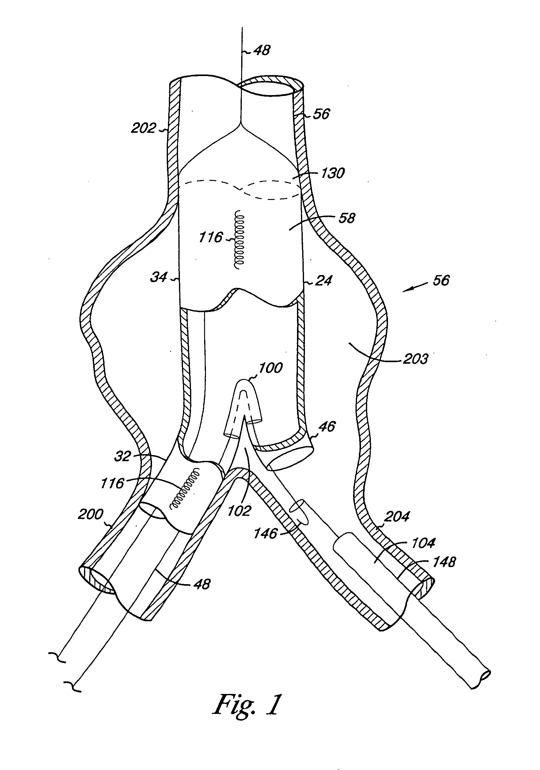 Endovascular graft including substructure for positioning and sealing within vasculature