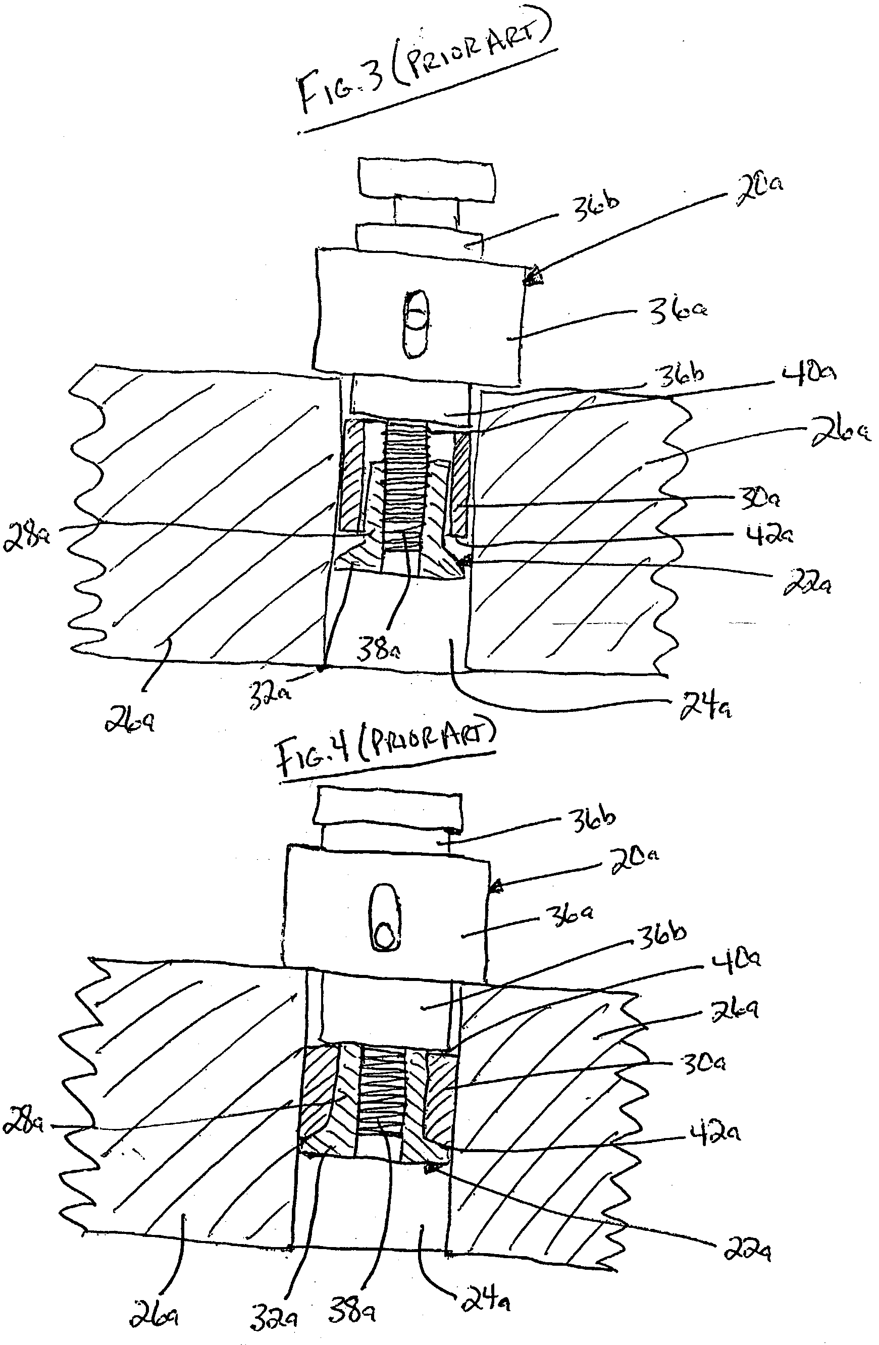 Installation tool for setting anchors