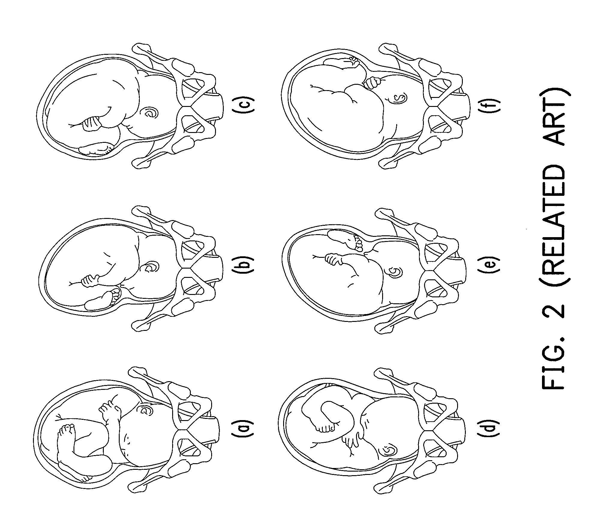 Apparatus and method for monitoring fetus in maternal body