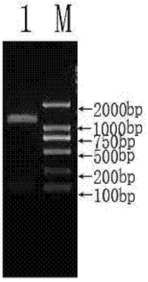 Riemerella anatipestifer antibody indirect ELISA method detection kit and application thereof