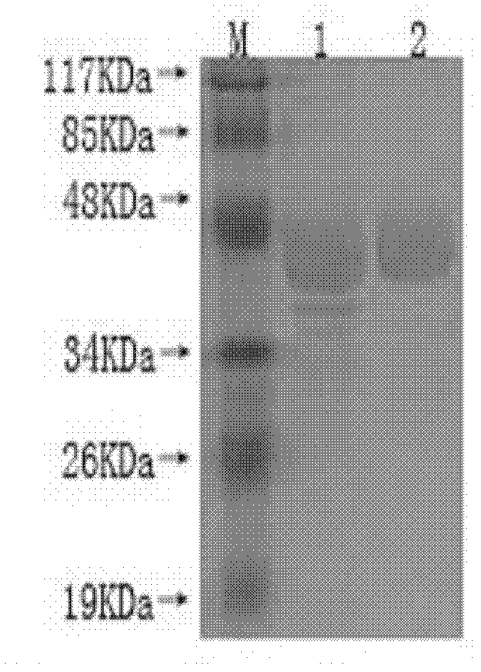 Riemerella anatipestifer antibody indirect ELISA method detection kit and application thereof