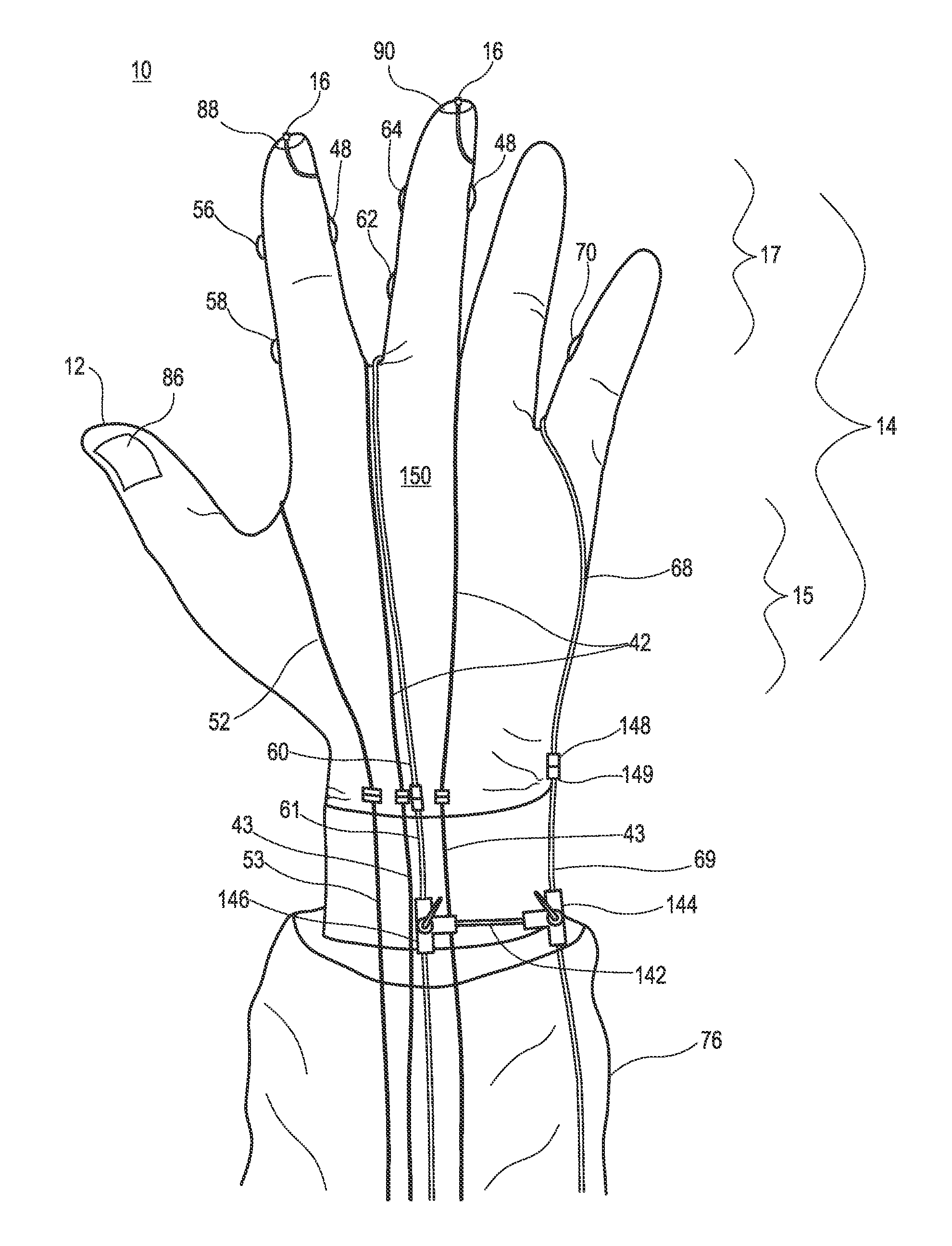 Surgical glove systems and method of using the same