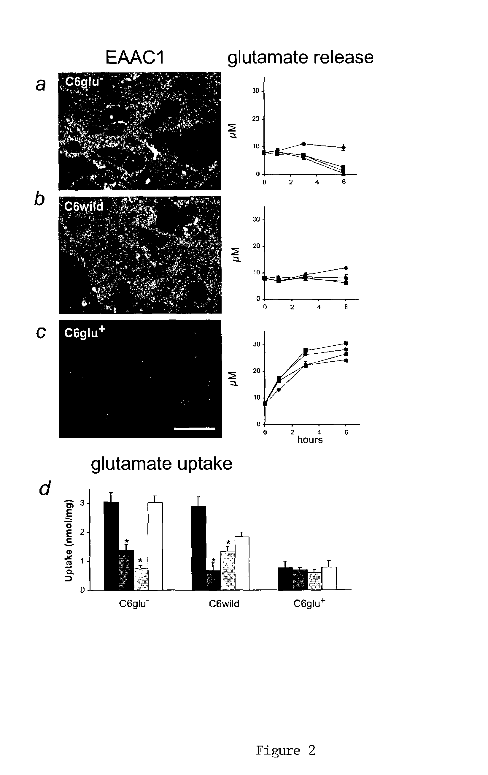 Treatment of glial tumors with glutamate antagonists