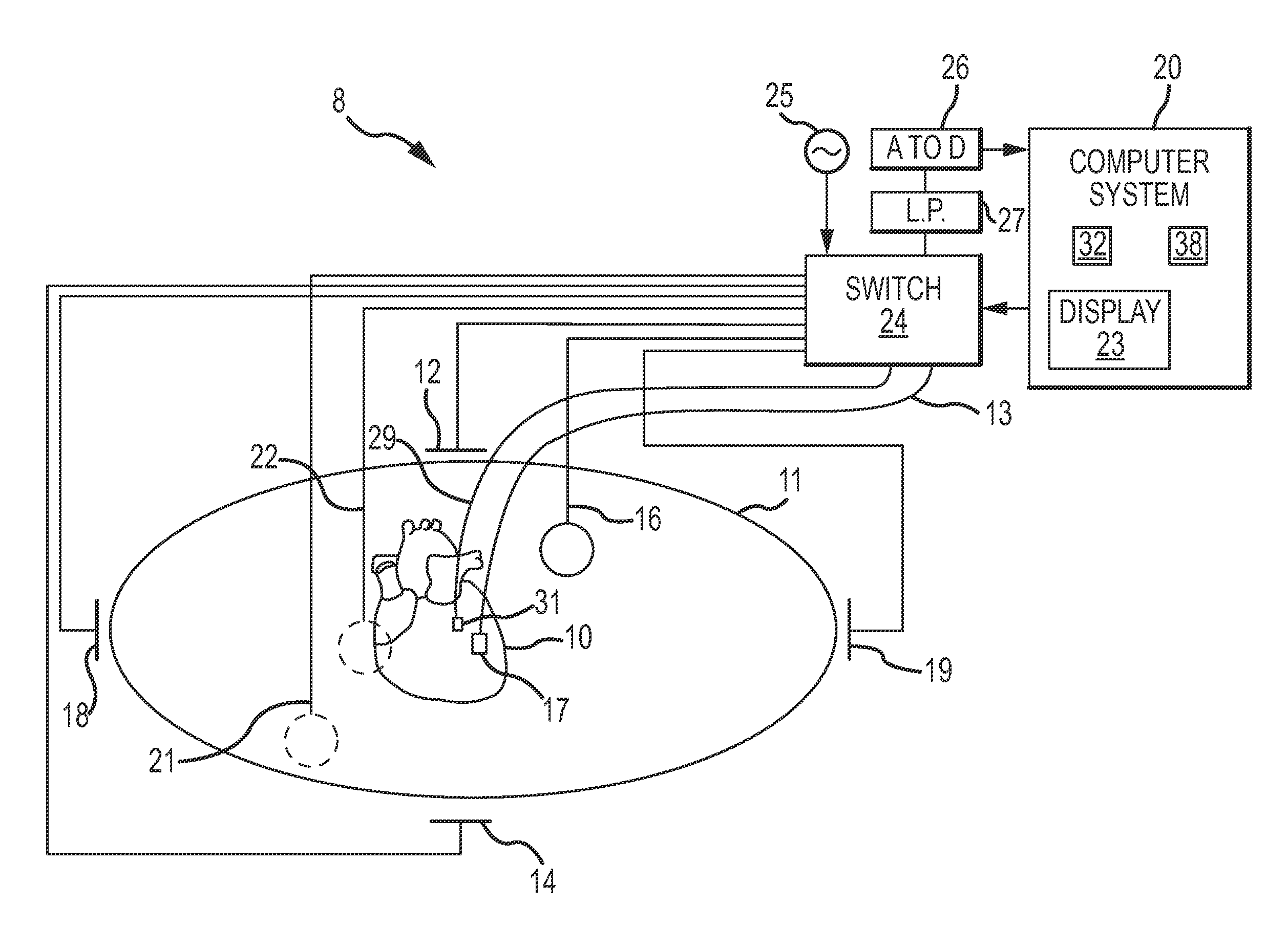 Cardiac mapping system and method for bi-directional activation detection of electrograms