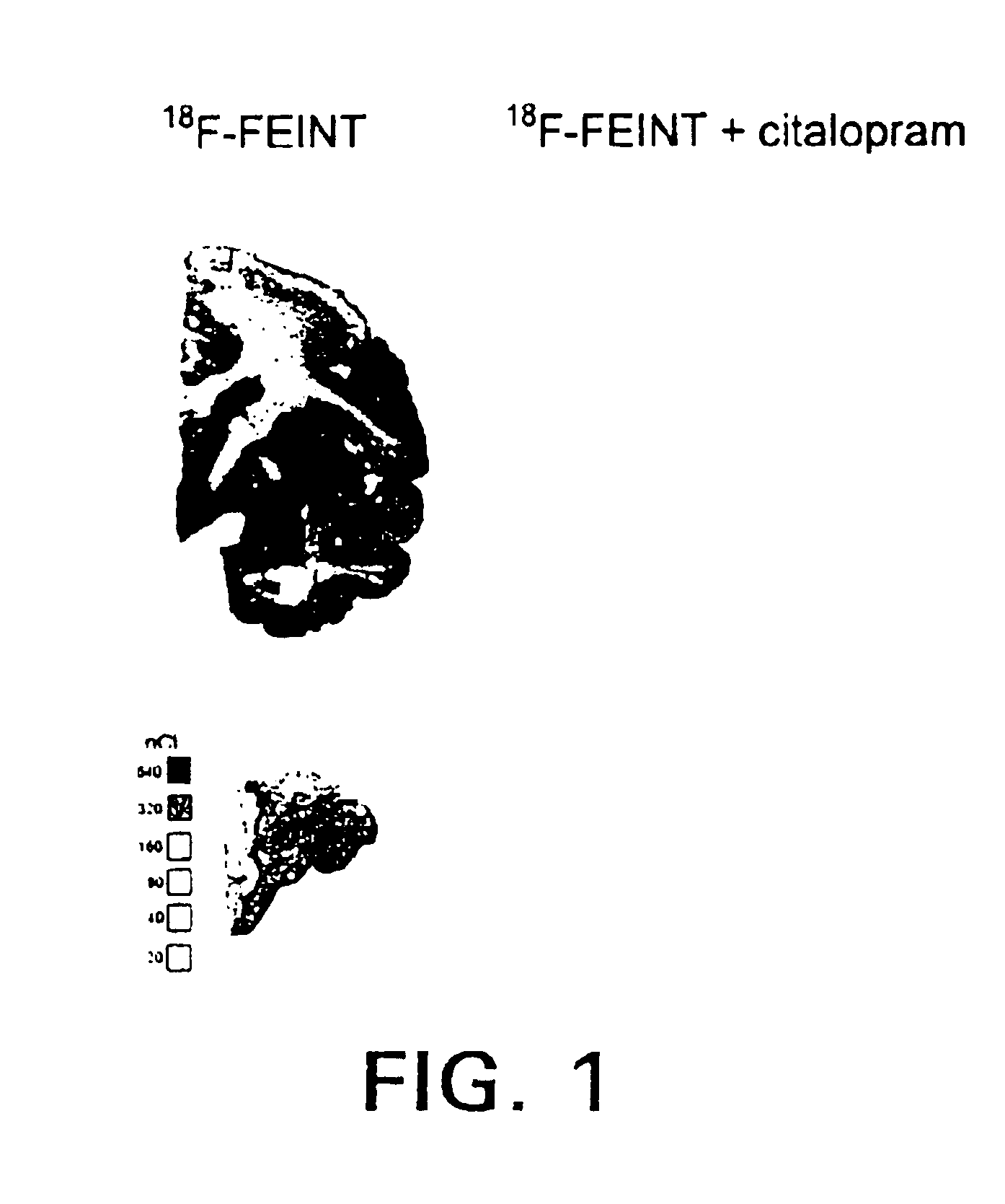 4-haloethenylphenyl tropane:serotonin transporter imaging agents