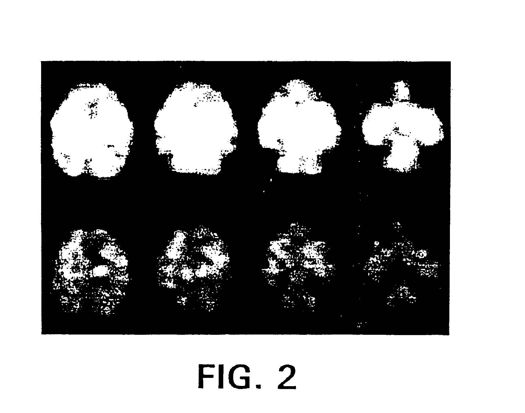 4-haloethenylphenyl tropane:serotonin transporter imaging agents