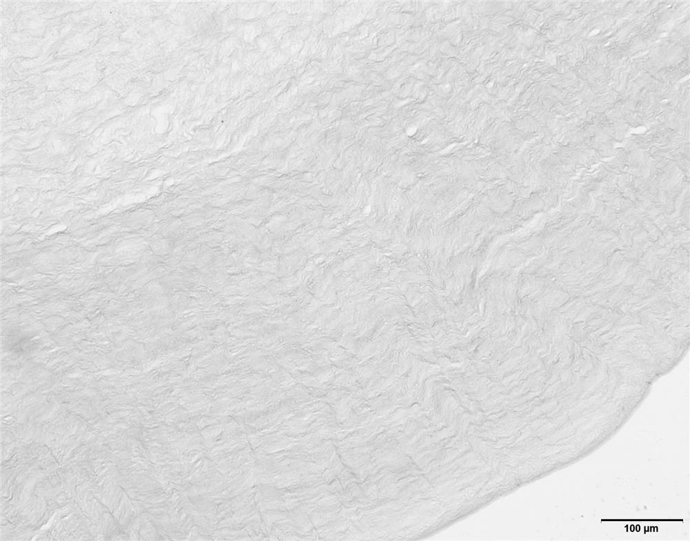 Acellular cornea and preparation method thereof